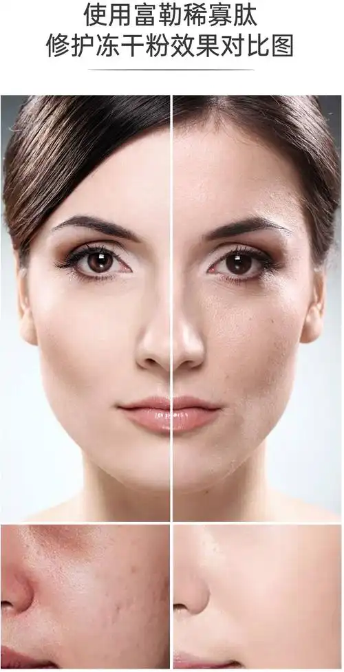 冻干粉套盒厂家批发 美容院冻干粉批发 修复敏感肌