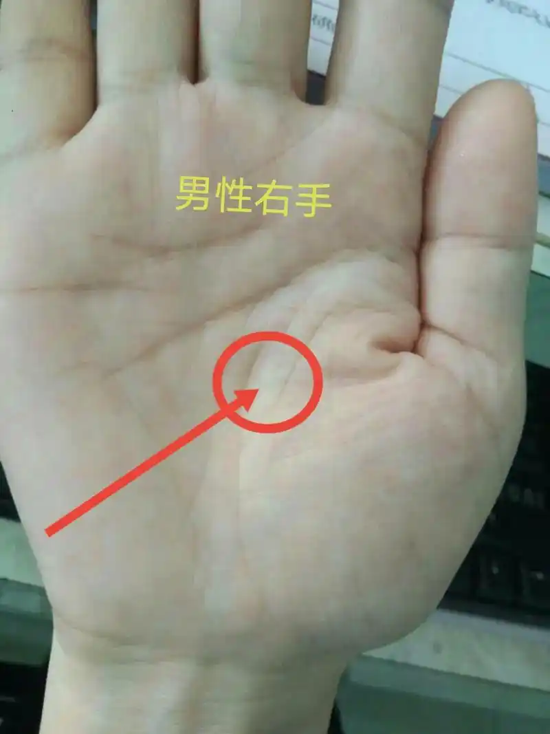 一旦手相左右手同时出现生命线图片中的纹路情况那么要注意了(大 - 抖