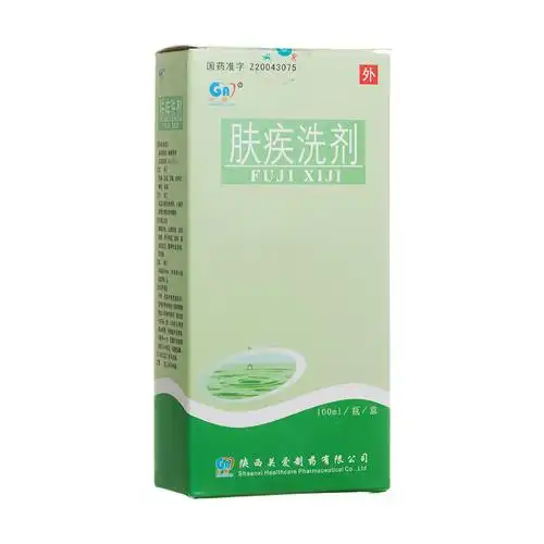 花斑癣会不会痒