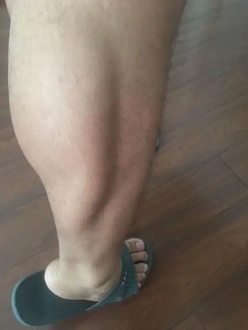 本人男18岁 腿很粗 而且小腿是肌肉腿 希望那位大神能指点我,给我一些