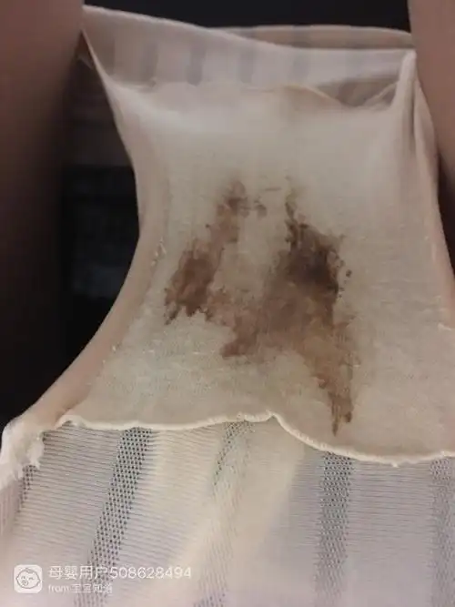 hpv时阴道出血了,今天内裤还有血丝,有事吗?