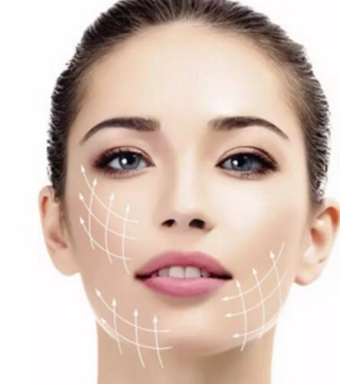 面部线雕多久才会好看