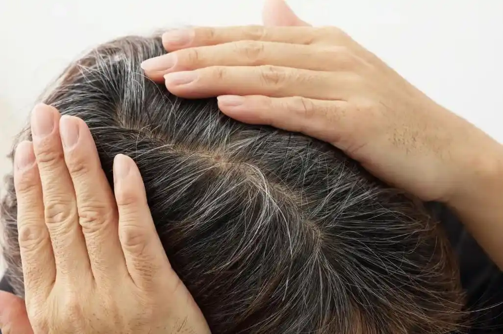 白头发可能是哪些原因导致的?