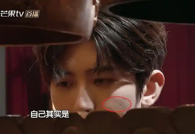 蔡徐坤皮肤怎么样当镜头拉近看到真实颜值后伤疤痘印太明显