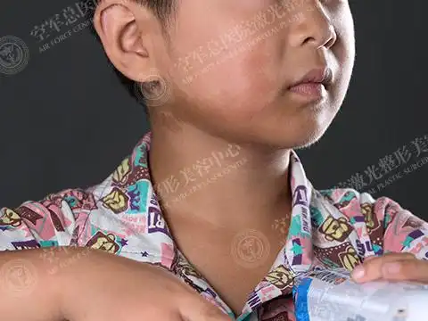 棕色不等,但每一片的颜色相同且十分均匀,深浅不受日晒的影响,大小自