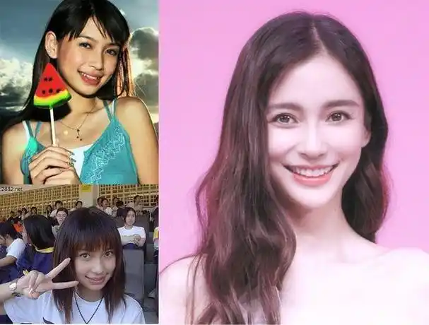 杨颖为了改善自己的凸嘴,做了下颌整形术