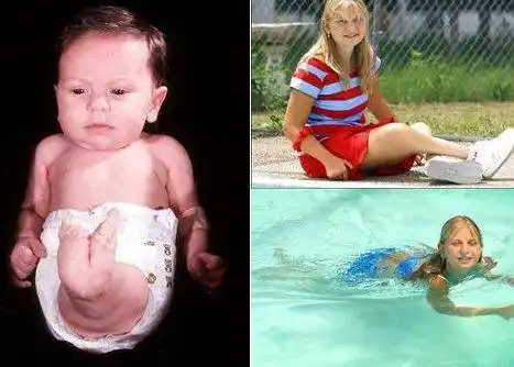 女子产下美人鱼宝宝,然而现实却不是童话