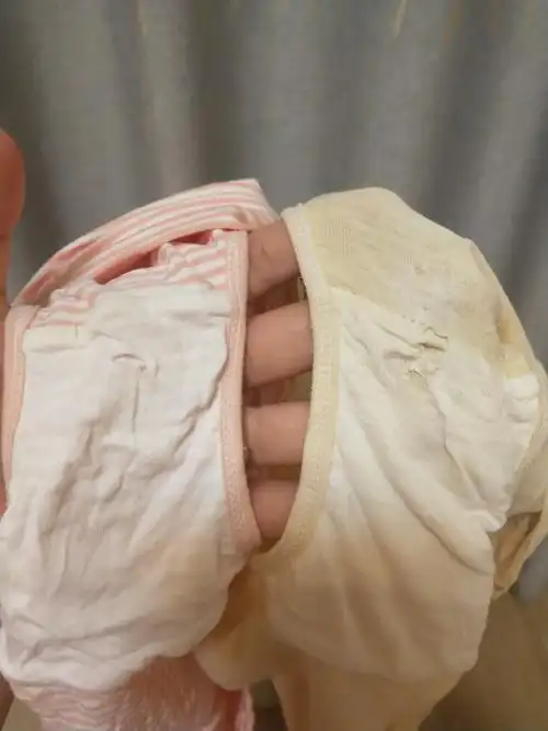 老是一点点一点点的漏尿内裤发黄这已经是我手洗搓烂的_妈妈网孕育