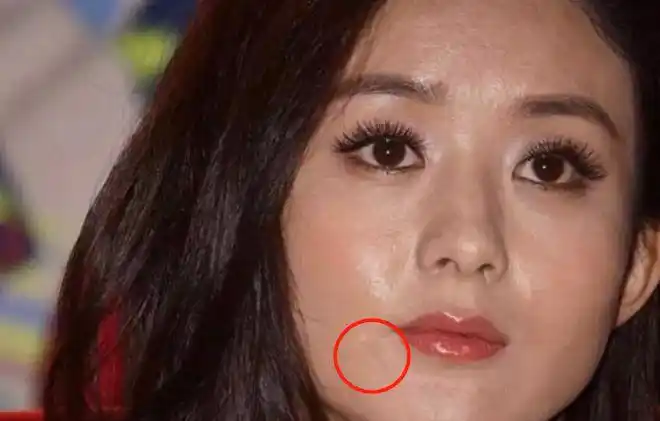 意外暴露额上一颗痘,浓眉大眼颜值精致|赵丽颖|痘痘|白皙_网易订阅