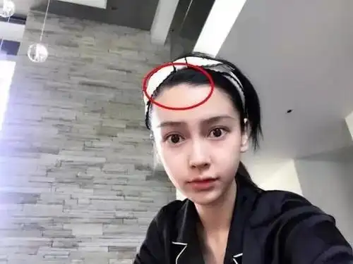 掀开刘海看发际线唐嫣比杨幂刘诗诗还高数她最美