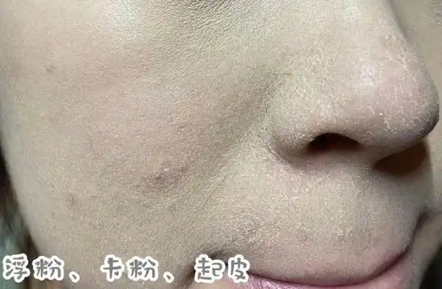 可以喷的水光精华!熬夜干燥,蜡黄脸,3秒get水光肌,立竿见影