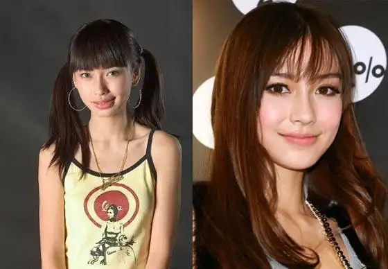 angelababy承认整容看杨颖angelababy整容前后照片