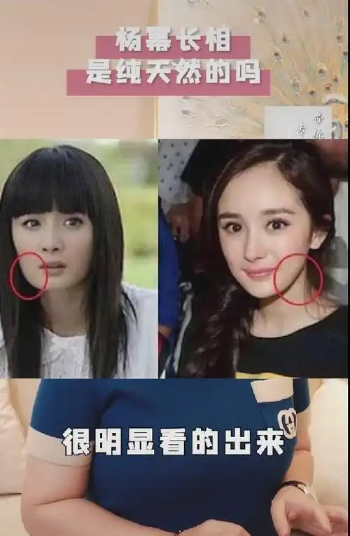 杨幂整容一事,称杨幂的下颚角肯定是动过的,并放出了早年时期的对比照