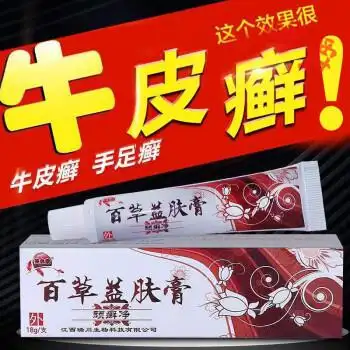 牛l皮l癣专用膏手l癣皮肤瘙痒湿l疹皮l炎瘙痒止痒股体l癣薬l膏顽固性