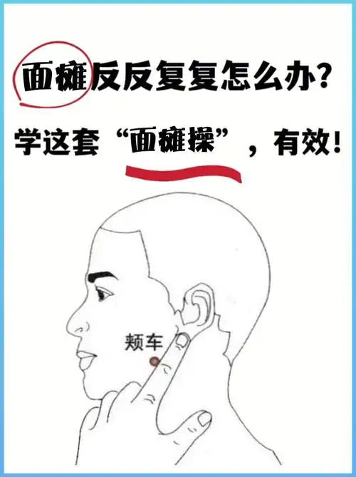 面瘫病人自我按摩及康复训练一,按摩[一r],从眉弓处向头顶发际处推拉