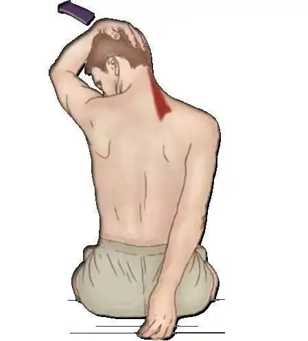 浅谈:练不对就会造成损伤的肩胛提肌