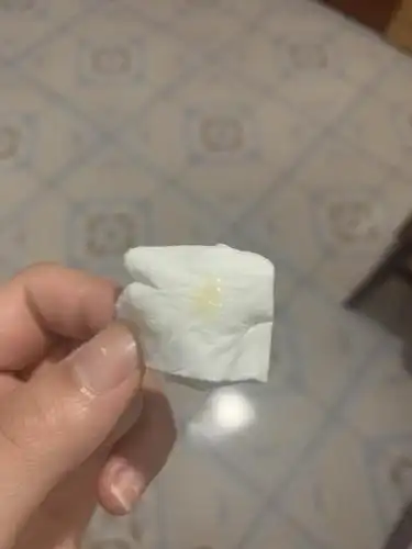 姐妹帮我看一下这个白带正常吗有图慎入