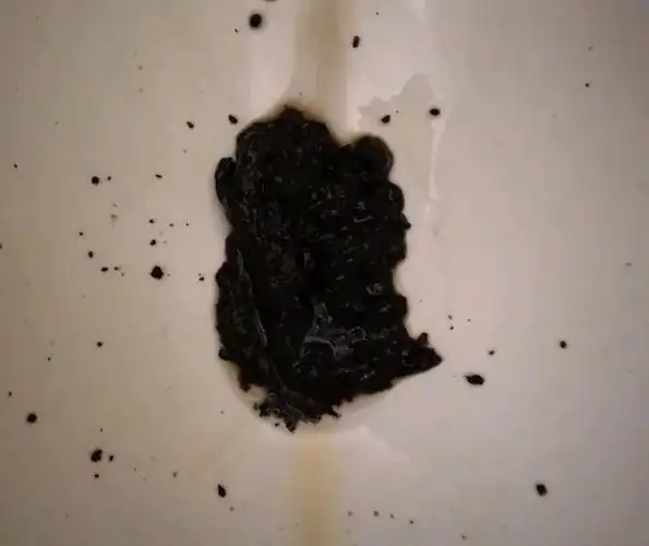 黑便的诊断和处理-春雨医生