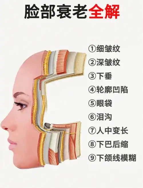 关于面部衰老的问题60