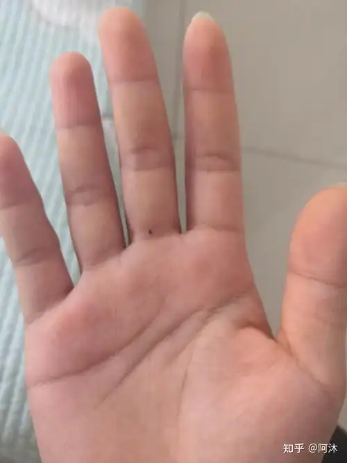 右手中指第二节上有黑痣这有什么寓意吗