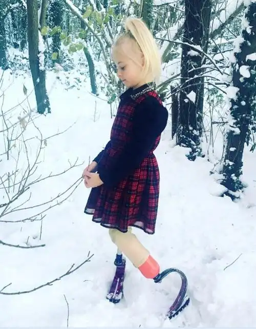 黛西有两套假肢,一套是普通的,生活和上学用的假肢,具备基本肢体功能.