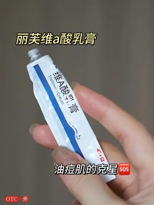 维a酸乳膏##维a酸乳膏功效和作用##维a酸乳膏使