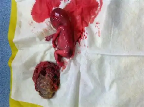 易造成流产的危险期基本结束,妈妈们可以参考四个月胎儿四维彩超图哦