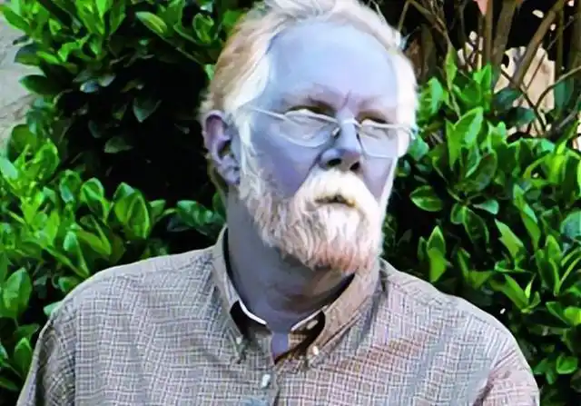 1960年科考队发现蓝血人村落,因久居高山,村民们的dna发生变异|人种