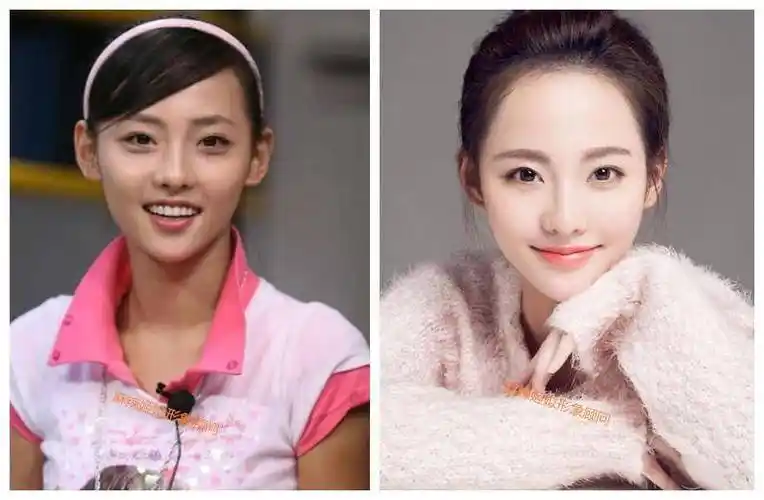 张嘉倪,造型跨度很大,既可以我见犹怜,也可以让人恨得痒痒