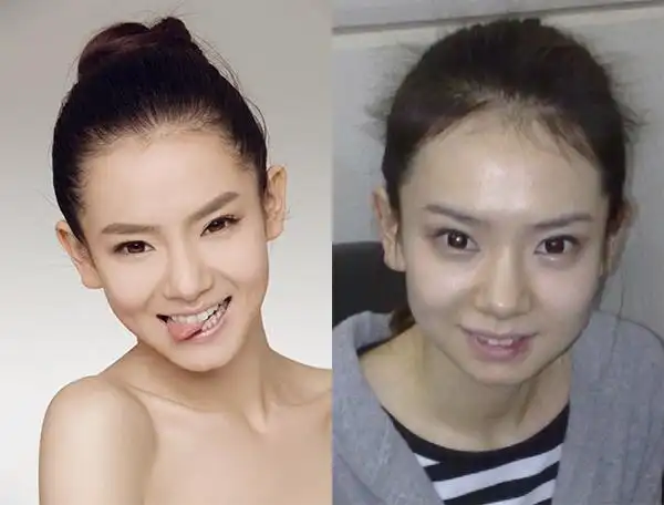 这就是网上盛传的所谓的"戚薇整容前后对比照",如果后面的一张照剖乔