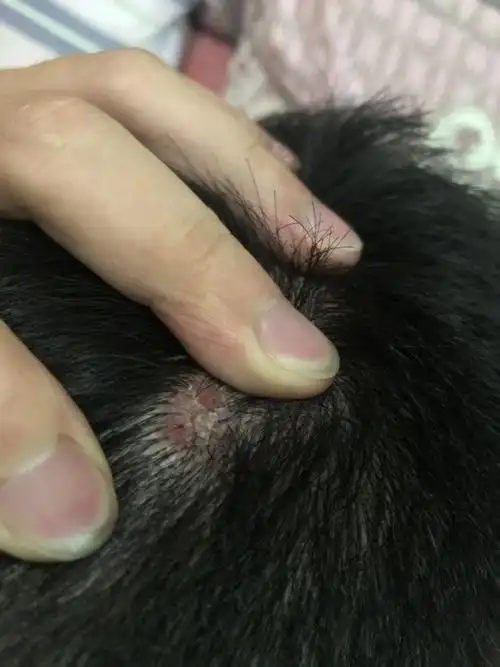 我想咨询下我这个是不是毛囊炎.