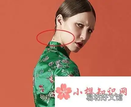 脖子上有痣代表什么