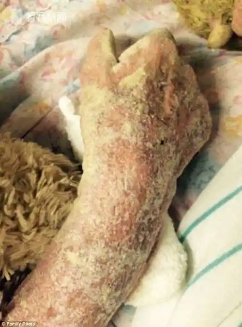 2010年,泽尼因患上老年痴呆症,被家人送往拉斐特的牧羊山养老院.