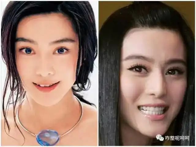 范冰冰从兔子一样的大门牙变成了整齐划一,排列有序的美牙