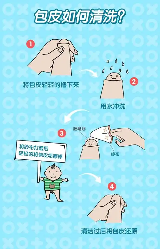 翻开包皮清洗时,不要用太刺激的清洁用品,只需用清水冲洗就可以了.