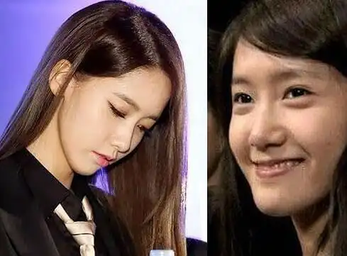 (已添新图)八一八整容前的林允儿