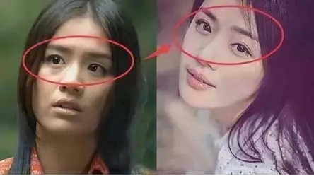 马思纯做双眼皮踩的坑,我劝大家别踩!