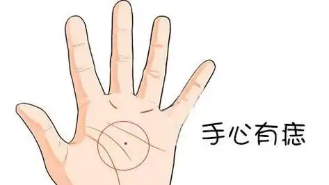 女人右手手掌边痣图解