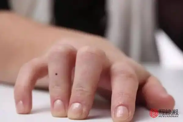 右手无名指突然长痣有什么含义