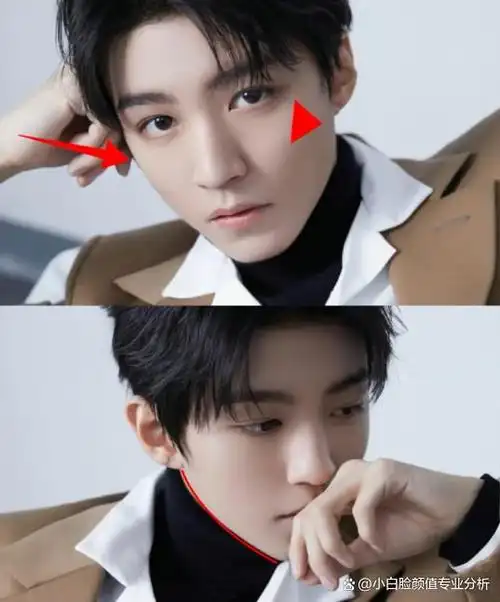 整形医生分析:王俊凯颜值胜在软组织恰到好处,自然生成贵气感