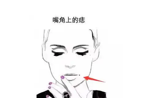 苦情痣,身体此处长恶痣,烂桃花不断,刑克伴侣,多婚命!