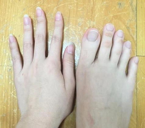 农村有句俗语"二拇脚趾头长,长大了不养娘"说的有道理吗?