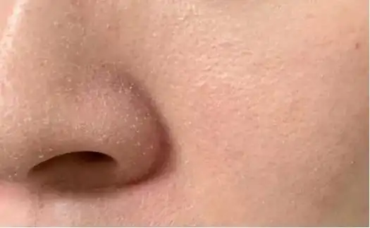 有了这些技巧,有助改善肌肤干燥问题!