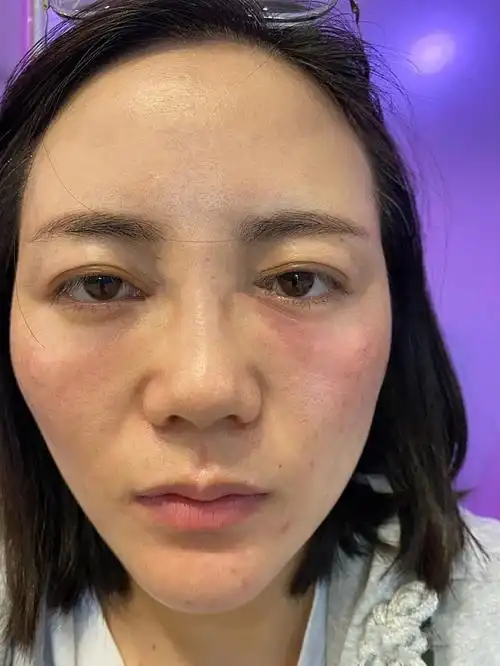 打泪沟的第一天