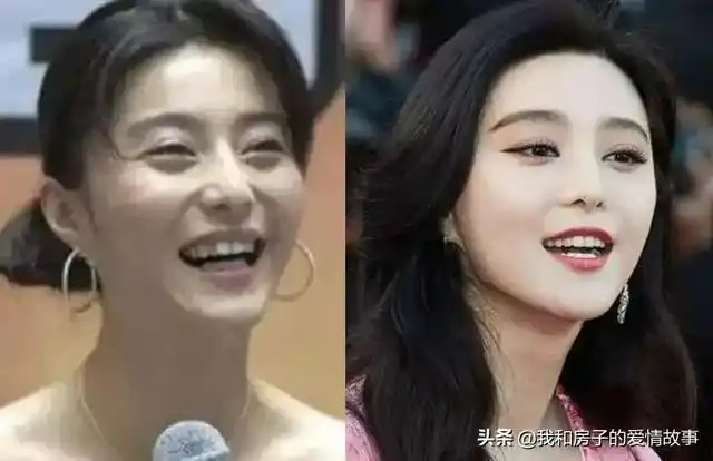 整牙就是比整容好一百倍