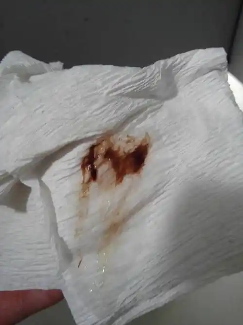 问答 问答首页  满意回答 你好,这个是排卵期出血引起的,以前排卵期