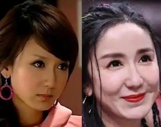 整容脸上镜有多垮这就是张艺谋坚决不用整容脸的原因吧