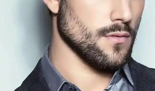 沧州激光脱络腮胡 沧州激光脱络腮胡医生