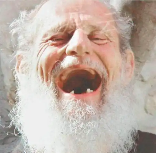 牙齿脱落不是老年人特有的,年轻人长点心吧,要不无牙了!