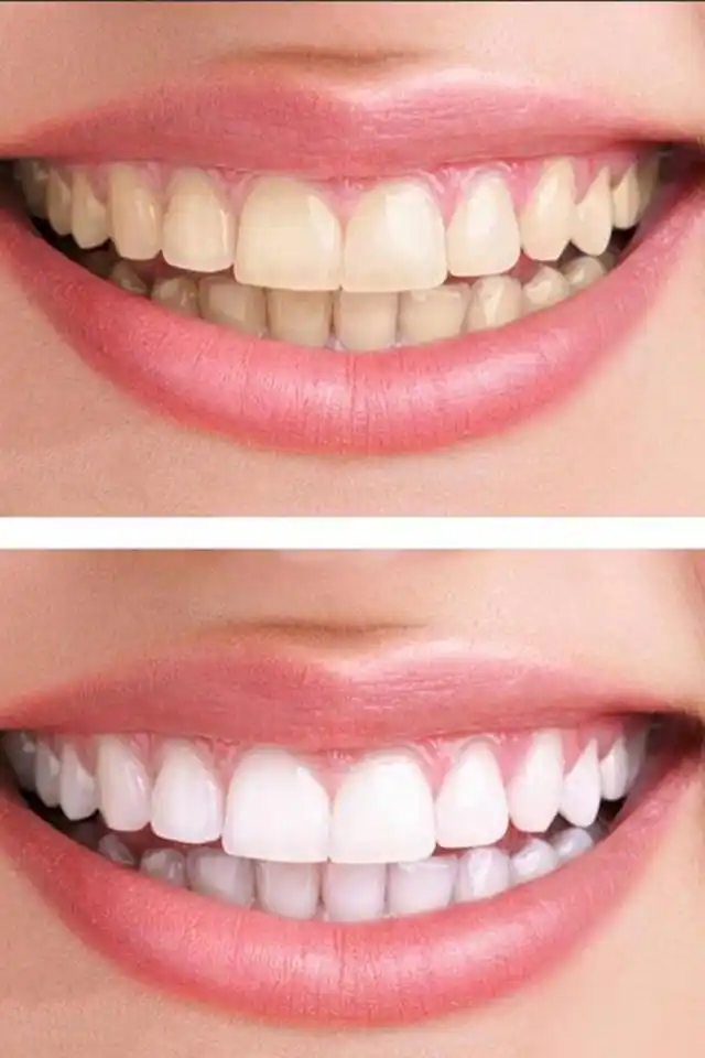 你离一个灿烂笑容只差一口白牙